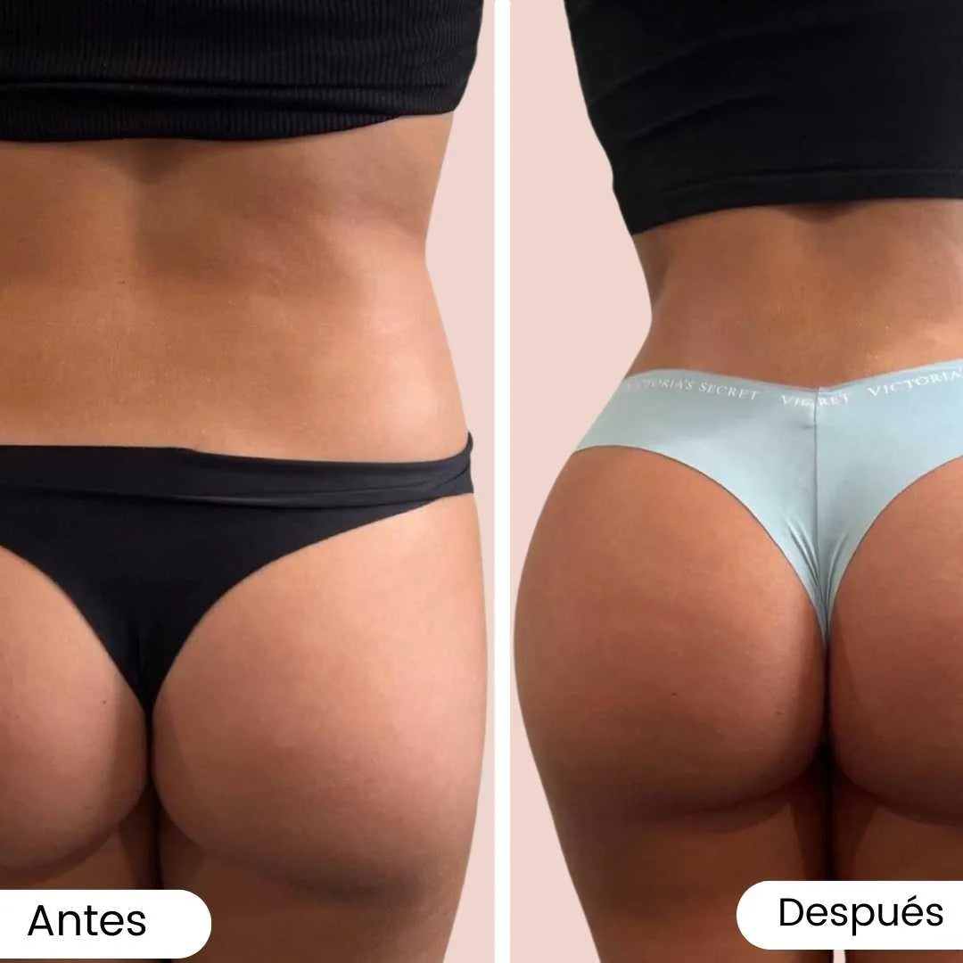 Crema LEVABE | Aumenta y Reafirma Glúteos en Semanas 🍑