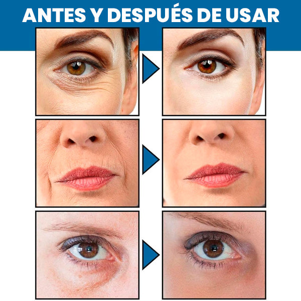 Crema Facial AntiARRUGAS-Blanqueadora con Retinol 30ml + REGALO