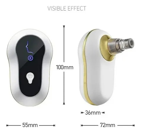 Extractor de Espinillas Eléctrico Profesional | Limpieza Facial Profunda en Casa + OBSEQUIO