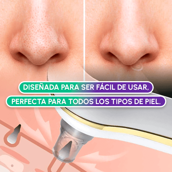 Extractor de Espinillas Eléctrico Profesional | Limpieza Facial Profunda en Casa + OBSEQUIO