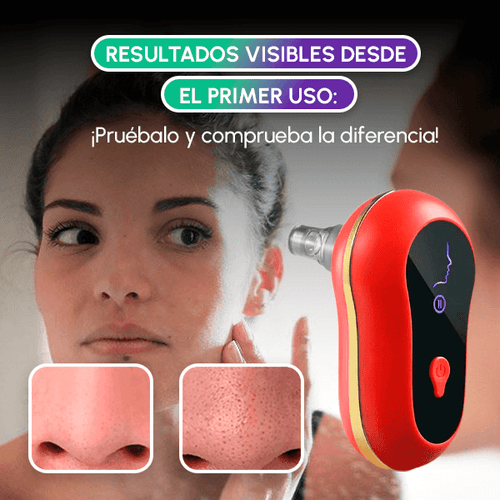 Extractor de Espinillas Eléctrico Profesional | Limpieza Facial Profunda en Casa + OBSEQUIO