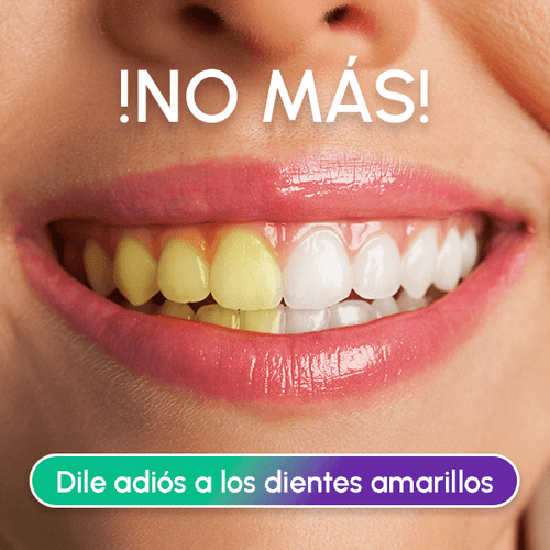 Pasta Dental Blanqueadora No Invasiva + OBSEQUIO