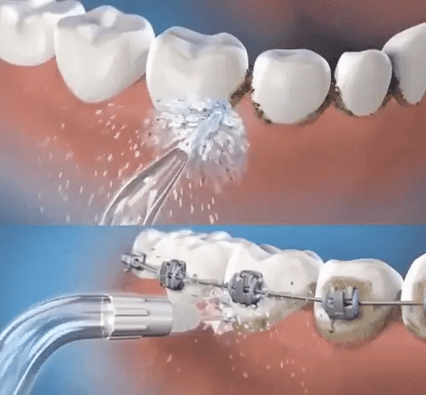limpieza profunda con Irrigador bucal portátil + OBSEQUIO