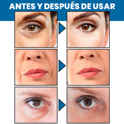 Crema Facial AntiARRUGAS-Blanqueadora con Retinol 30ml + REGALO