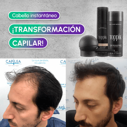 Cabello instantáneo + Envío GRATIS