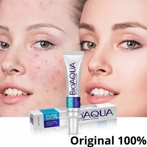 Crema Anti Acné "Bioaqua"