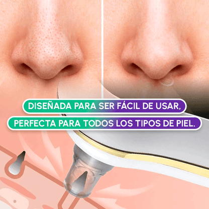 Extractor de Espinillas Eléctrico Profesional | Limpieza Facial Profunda en Casa + OBSEQUIO