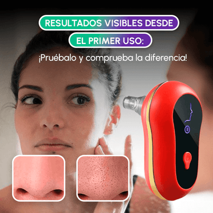 Extractor de Espinillas Eléctrico Profesional | Limpieza Facial Profunda en Casa + OBSEQUIO