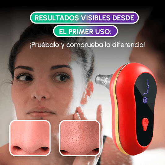 Extractor de Espinillas Eléctrico Profesional | Limpieza Facial Profunda en Casa + OBSEQUIO