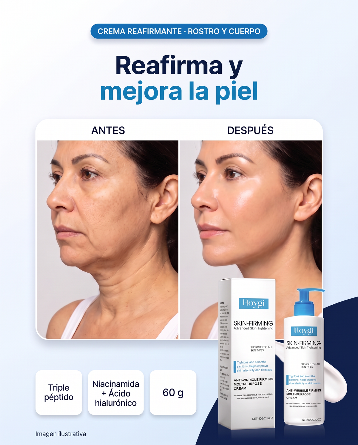 Crema reafirmante Hoygi