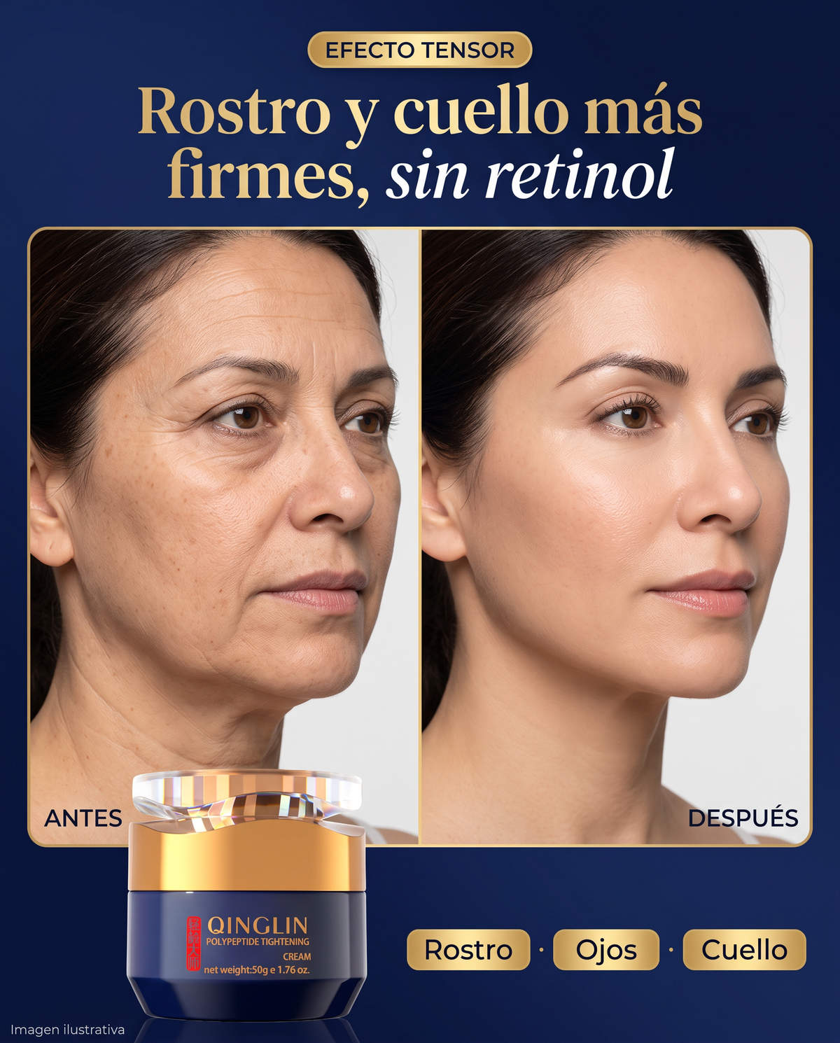 Crema facial Qinglin, tamaño y diseño del envase