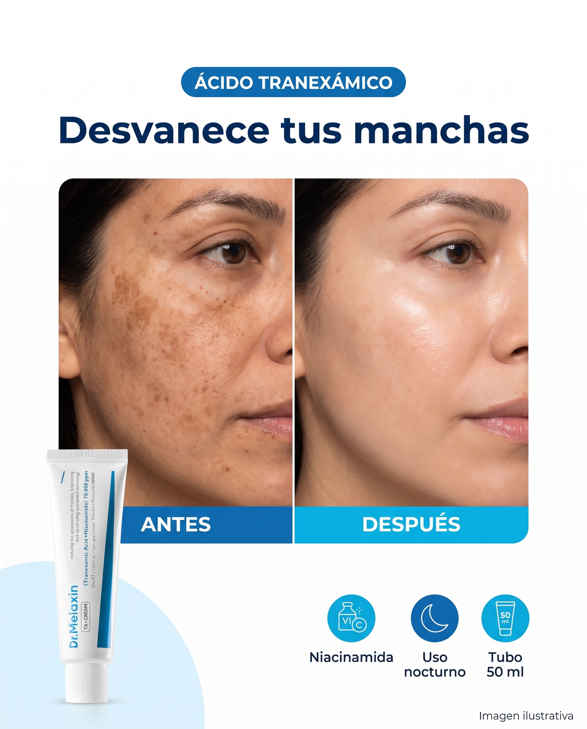 Dr.Melaxin TX-Cream, crema para manchas